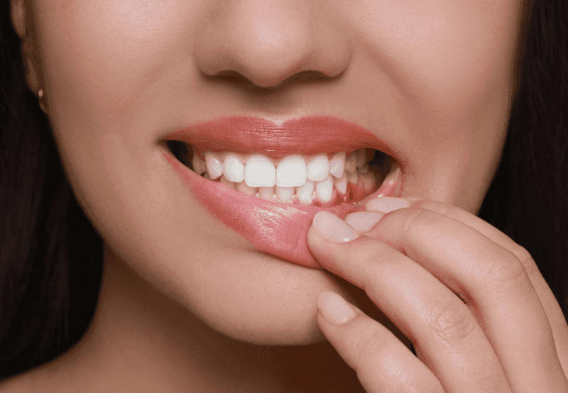 bleeding gums